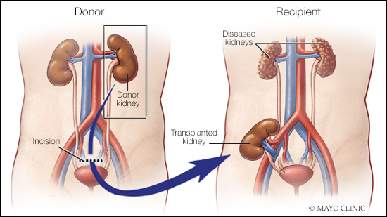 Urologist in Nashik | Dr. Chintaman Chaudhari | Laxminarayan Hospital