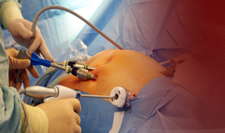 Urologic laparoscopy in Nashik | Shree Laxminarayan Hospital